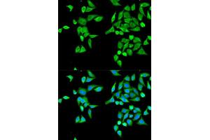 Immunofluorescence analysis of MCF-7 cell using CES2 antibody. (CES2 anticorps  (AA 310-410))