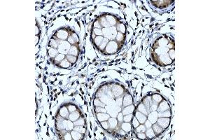Immunohistochemistry of paraffin-embedded human colon using NELFCD Rabbit pAb (ABIN1683024, ABIN3019182, ABIN3019183 and ABIN6220747) at dilution of 1:50 (40x lens).