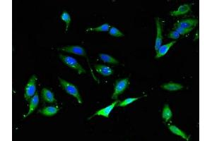 Immunofluorescent analysis of Hela cells using ABIN7161494 at dilution of 1:100 and Alexa Fluor 488-congugated AffiniPure Goat Anti-Rabbit IgG(H+L)
