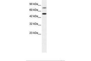 Image no. 1 for anti-Choroideremia-Like (Rab Escort Protein 2) (CHML) (AA 122-171) antibody (ABIN6735875) (CHML anticorps  (AA 122-171))