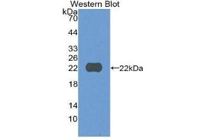 Western Blotting (WB) image for anti-Cylindromatosis (Turban Tumor Syndrome) (CYLD) (AA 170-338) antibody (ABIN1867482)