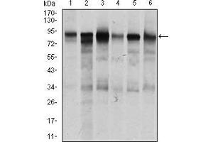 TGFBR3 anticorps  (AA 147-328)