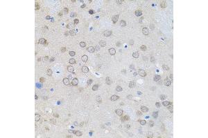 Immunohistochemistry of paraffin-embedded rat brain using UBE2A antibody.
