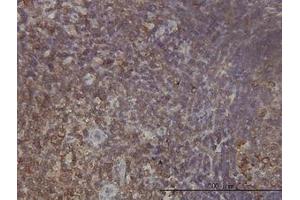 Image no. 1 for anti-Ribosomal Protein L9 (RPL9) (AA 93-192) antibody (ABIN598584) (RPL9 anticorps  (AA 93-192))