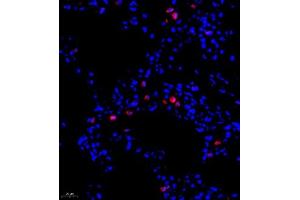 Immunofluorescence of paraffin embedded rat lung using ADI1 (ABIN7072888) at dilution of 1:1200 (400x lens) (ADI1 anticorps)