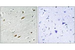 Immunohistochemistry analysis of paraffin-embedded human brain tissue, using FKHR (Ab-319) Antibody. (FOXO1 anticorps  (AA 286-335))