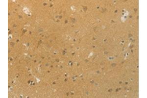 The image on the left is immunohistochemistry of paraffin-embedded Human brain tissue using ABIN7192532(SLC9A3 Antibody) at dilution 1/20, on the right is treated with synthetic peptide. (SLC9A3 anticorps)