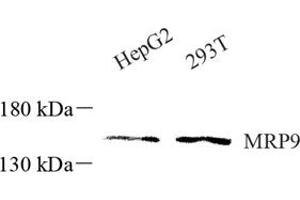 Western blot analysis of ABCC12 (ABIN7073147) at dilution of 1: 600 (ABCC12 anticorps)