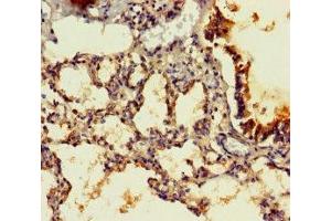Immunohistochemistry of paraffin-embedded human lung tissue using ABIN7165919 at dilution of 1:100 (PPP1R16B anticorps  (AA 101-400))