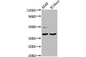 Western Blot Positive WB detected in: A549 whole cell lysate, Rat kidney tissue All lanes: LGALS12 antibody at 3 μg/mL Secondary Goat polyclonal to rabbit IgG at 1/50000 dilution Predicted band size: 38, 32, 37, 30, 36 kDa Observed band size: 38 kDa (LGALS12 anticorps  (AA 1-336))