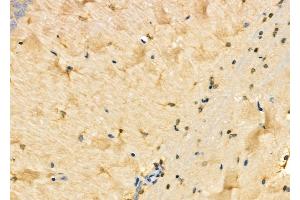 ABIN6258469 and ABIN6275385 at 1/100 staining Rat brain tissue by IHC-P.