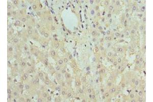 Immunohistochemistry of paraffin-embedded human liver tissue using ABIN7153202 at dilution of 1:100 (FBP1 anticorps  (AA 1-338))