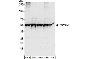 Western Blotting (WB) image for anti-RuvB-Like 1 (E. Coli) (RUVBL1) (AA 200-250) antibody (ABIN7450703)