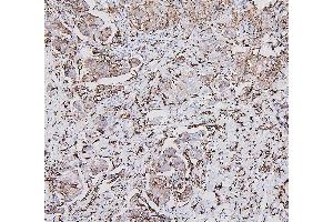 IHC analysis of HLA-DRA using anti-HLA-DRA antibody (ABIN7600948). (HLA-DRA anticorps  (AA 26-254))
