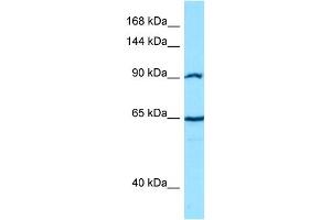 Host: Rabbit Target Name: CTNNA2 Sample Type: PANC1 Whole cell lysates Antibody Dilution: 1. (CTNNA2 anticorps  (C-Term))
