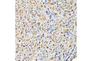 Immunohistochemistry of paraffin-embedded rat ovary using RBBP9 Rabbit pAb (ABIN6129095, ABIN6146752, ABIN6146753 and ABIN6220638) at dilution of 1:200 (40x lens). (RBBP9 anticorps  (AA 1-186))