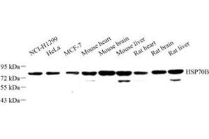 Western blot analysis of HSP70B (ABIN7074173) at dilution of 1: 500 (HSPA6 anticorps)