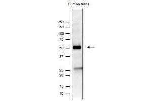 Western Blotting (WB) image for anti-Izumo Sperm-Egg Fusion 1 (IZUMO1) antibody (ABIN2452040) (IZUMO1 anticorps)