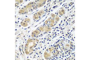 Immunohistochemistry of paraffin-embedded human stomach using GPRC5A antibody at dilution of 1:100 (40x lens). (GPRC5A anticorps)