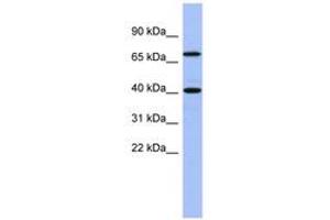 Image no. 1 for anti-SLAIN Motif Family, Member 2 (SLAIN2) (AA 71-120) antibody (ABIN6743288) (SLAIN2 anticorps  (AA 71-120))