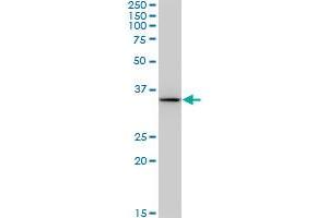 BDH1 monoclonal antibody (M03A), clone 4B3.