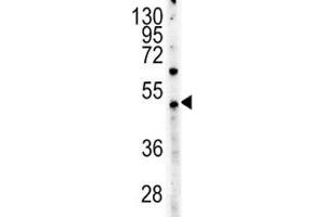 c-Myc antibody western blot analysis in HeLa lysate (Myc Tag anticorps  (AA 408-439))