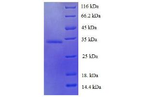 Trefoil Factor 1 (TFF1) (AA 25-84) protein (His tag) expressed in E. (TFF1 Protein (AA 25-84) (His tag))