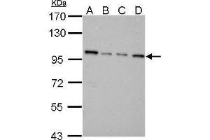 WB Image NNT antibody detects NNT protein by Western blot analysis. (NNT anticorps  (C-Term))