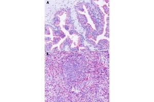 Immunohistochemical staining of formalin-fixed paraffin-embedded human prostate (A) and human spleen (B) with GPR63 polyclonal antibody . (GPR63 anticorps  (Extracellular Domain))