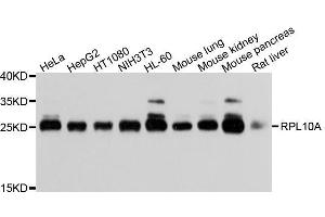 Western blot analysis of extracts of various cell lines, using RPL10A antibody. (RPL10A anticorps  (AA 1-110))