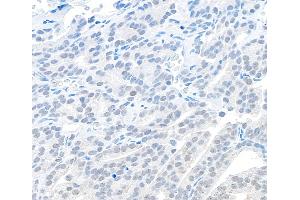 Immunohistochemistry (IHC) image for anti-Chromosome 11 Open Reading Frame 30 (C11orf30) (C-Term) antibody (ABIN7454601)