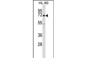 BTK Antibody (N-term) (ABIN657469 and ABIN2846497) western blot analysis in HL-60 cell line lysates (35 μg/lane). (BTK anticorps  (N-Term))