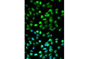 Immunofluorescence analysis of HeLa cell using TCF4 antibody.