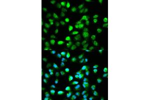 Immunofluorescence analysis of HeLa cell using TCF4 antibody. (TCF4 anticorps  (AA 400-500))