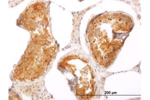 Immunoperoxidase of monoclonal antibody to SLMAP on formalin-fixed paraffin-embedded human testis.