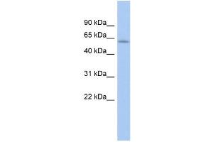 WB Suggested Anti-LEMD2 Antibody Titration: 0. (LEMD2 anticorps  (Middle Region))