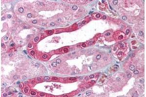 Human Kidney (formalin-fixed, paraffin-embedded stained with CA2 antibody ABIN214022 at 5 ug/ml followed by biotinylated goat anti-rabbit IgG secondary antibody ABIN481713, alkaline phosphatase-streptavidin and chromogen. (CA2 anticorps)