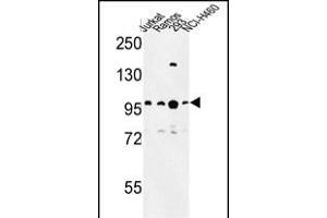 Western blot analysis of BCL11A Antibody (C-term) (ABIN653582 and ABIN2842956) in Jurkat, Ramos, 293, NCI- cell line lysates (35 μg/lane). (BCL11A anticorps  (C-Term))