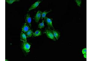 Immunofluorescent analysis of Hela cells using ABIN7146559 at dilution of 1:100 and Alexa Fluor 488-congugated AffiniPure Goat Anti-Rabbit IgG(H+L)