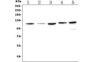 Western blot analysis of EPHB2 using anti-EPHB2 antibody (ABIN7601057).