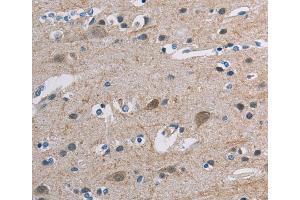 Immunohistochemistry (IHC) image for anti-Tonsoku-Like, DNA Repair Protein (NFKBIL2) antibody (ABIN2427657)