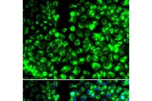 Immunofluorescence analysis of HeLa cells using CALU Polyclonal Antibody (CALU anticorps)