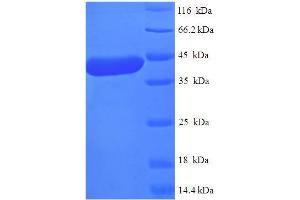 SDS-PAGE (SDS) image for Methyltransferase Like 11A (METTL11A) (AA 1-223), (full length) protein (His-SUMO Tag) (ABIN5711881)