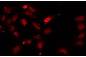 Immunofluorescence analysis of U2OS cells using HNRNPF Polyclonal Antibody (HNRNPF anticorps)