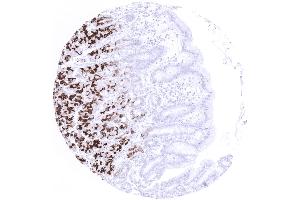 Moderate to strong MUC6 positivity in the mucous secreting glands but not the surface epithelium of the stomach