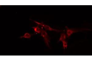 ABIN6274838 staining HeLa cells by IF/ICC.