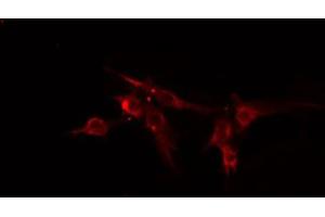ABIN6274838 staining HeLa cells by IF/ICC. (Amphiphysin anticorps  (Internal Region))