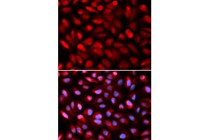 Immunofluorescence analysis of U2OS cells using PCBP2 antibody. (PCBP2 anticorps)