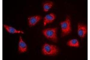 Immunofluorescent analysis of SGK1 staining in HEK293T cells. (SGK1 anticorps  (C-Term))