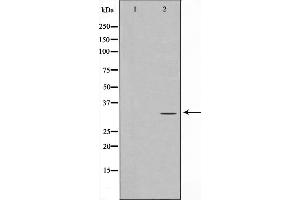 Western blot analysis of RFA2 phosphorylation expression in Adriamycin treated HeLa whole cell lysates,The lane on the left is treated with the antigen-specific peptide. (RPA2 anticorps  (pThr21))